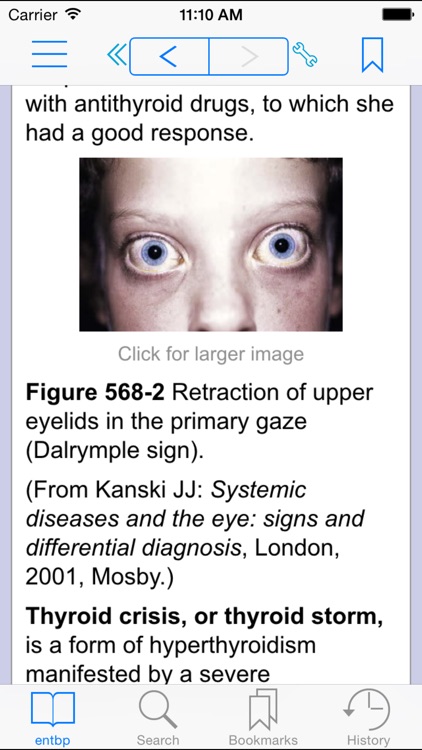 Nelson TB of Pediatrics, 20ED