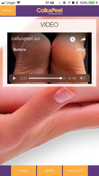 Callus Peel screenshot-4