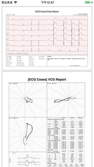 ECG Pro - 海量心電圖案例和診斷詳解(圖5)-速報App