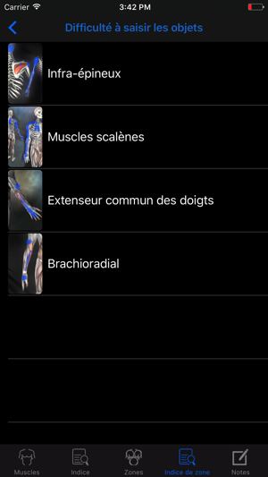 Trigger Points Myofasciaux(圖4)-速報App