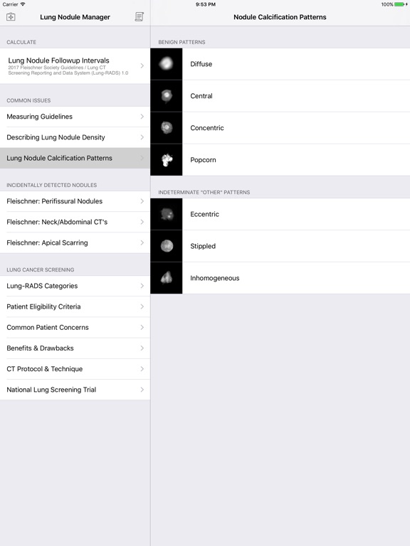 Lung Nodule Followup Managerのおすすめ画像4