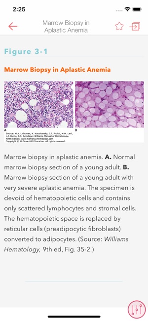 Williams Manual of Hematology(圖4)-速報App