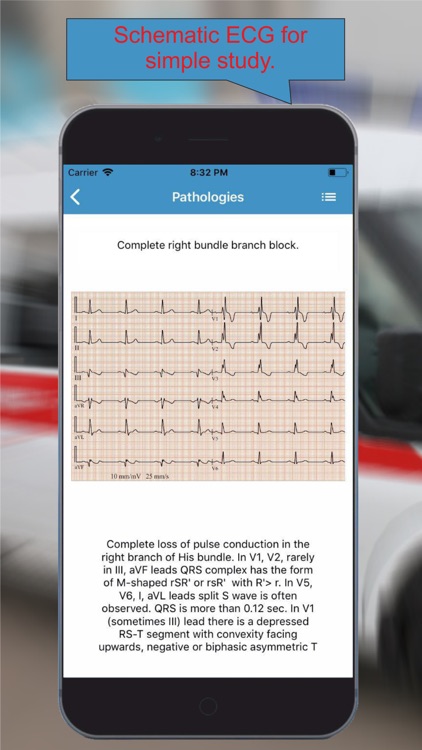 ECG: Interpritation and Tests.