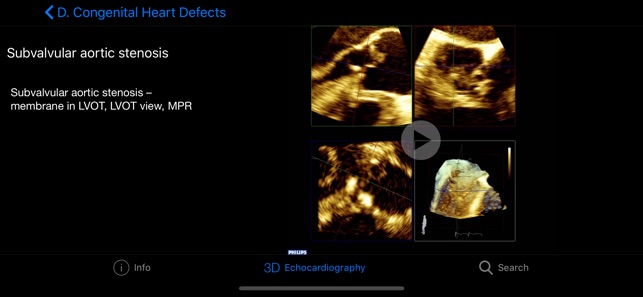 CARDIO3® 3D Echocardiography(圖5)-速報App