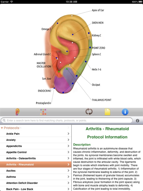 Auriculo HD screenshot-4