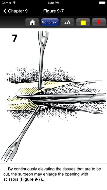 Zollingers Atlas of Surgery screenshot-3