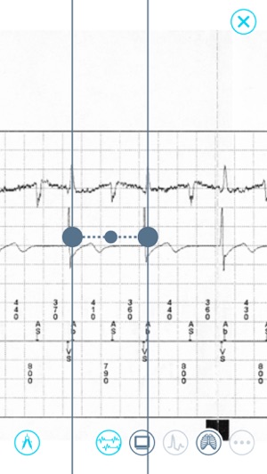 Cardiac Device Challenge(圖5)-速報App