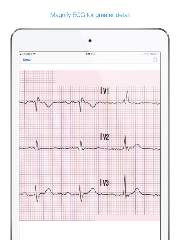 12 Lead ECG Challenge AppRecs