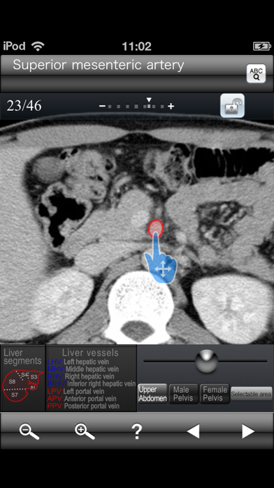 Abdominal CT Sectional Walkerのおすすめ画像1