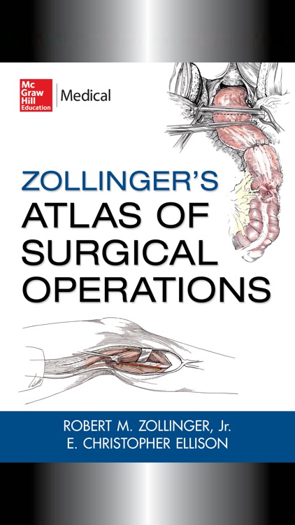 Zollingers Atlas of Surgery