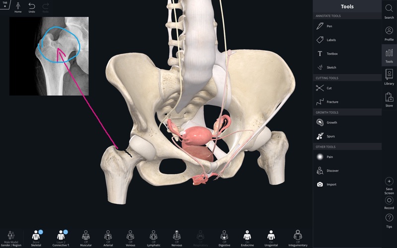Complete_Anatomy_2019.app caprure 5 5_Complete_Anatomy_2019.jpg