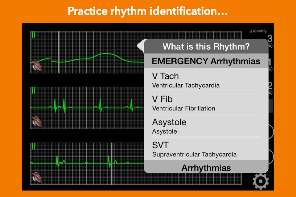 arrhythmia screenshot 2