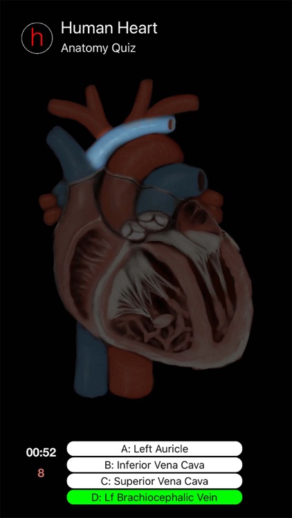 Human Heart Anatomy Quiz screenshot-4