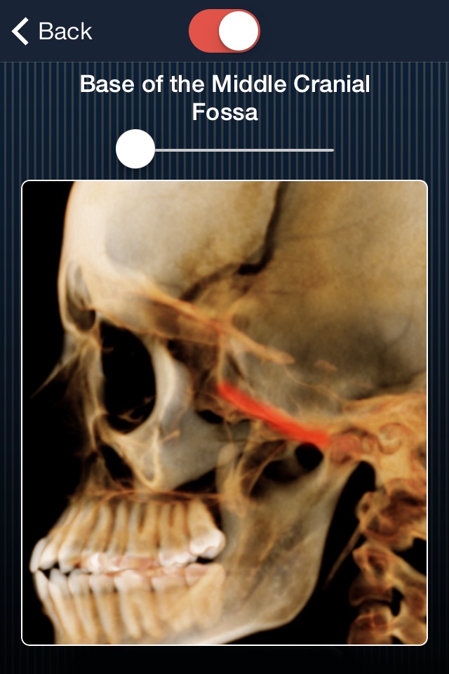 Dental Panoramic Radiology screenshot 4