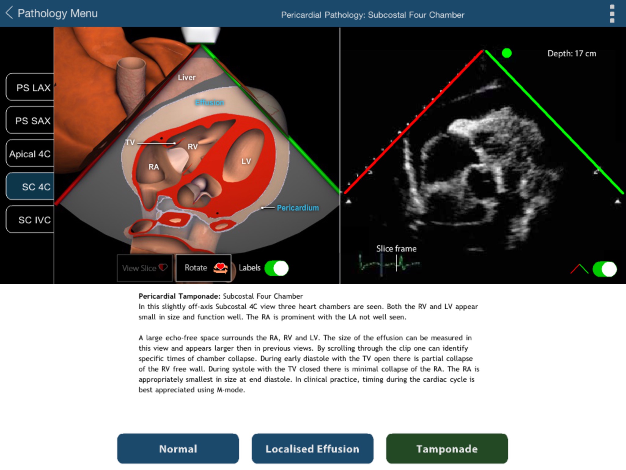 TTE FOCUS Views screenshot 4