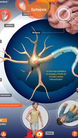 GSK Epilepsia(圖2)-速報App