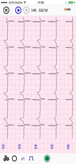 UltraLS   ECG SpO2 TEMP(圖3)-速報App