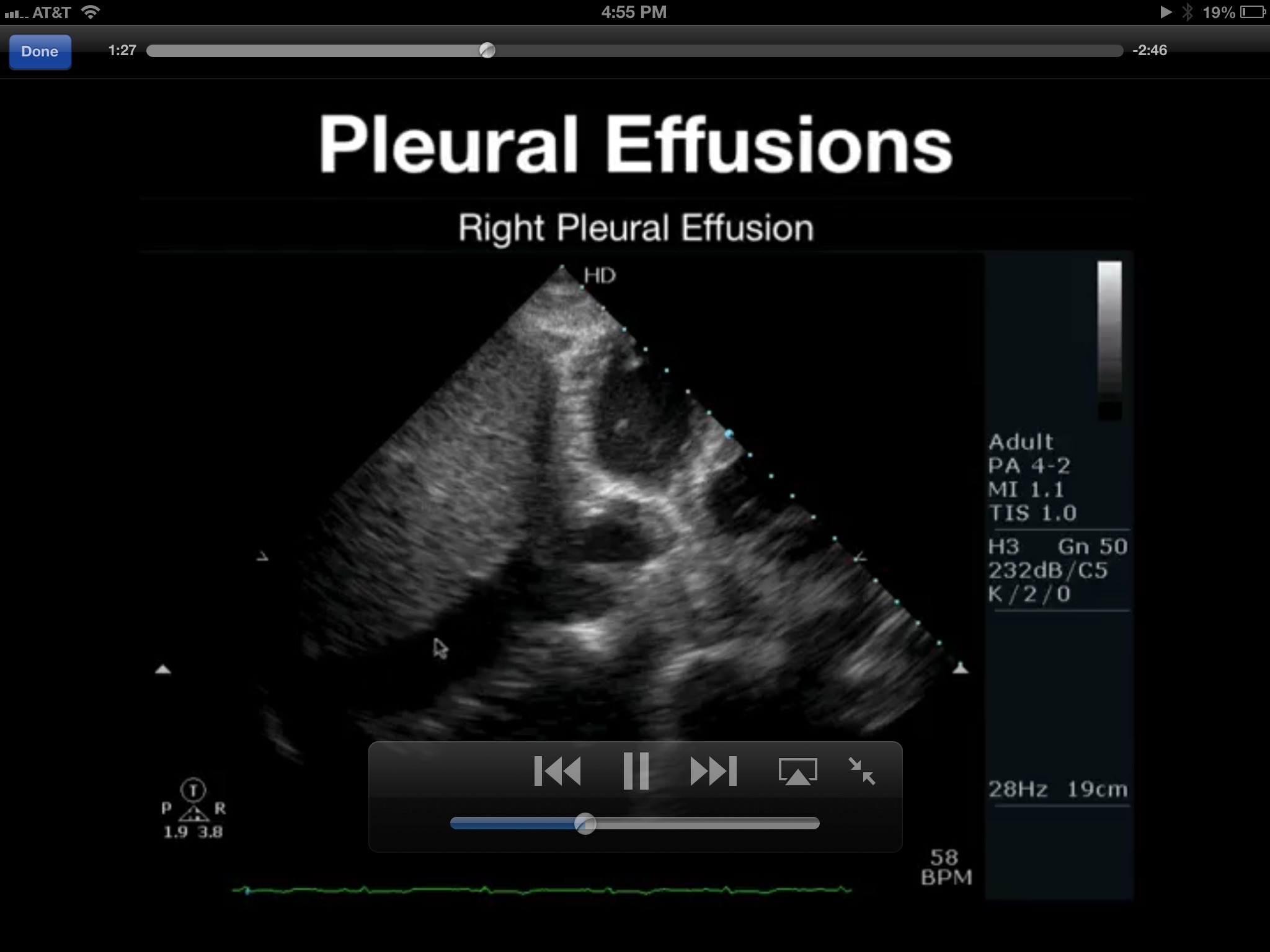 Trauma Ultrasound eBook screenshot 4