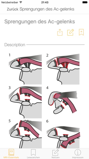 MRI-Essentials(圖3)-速報App