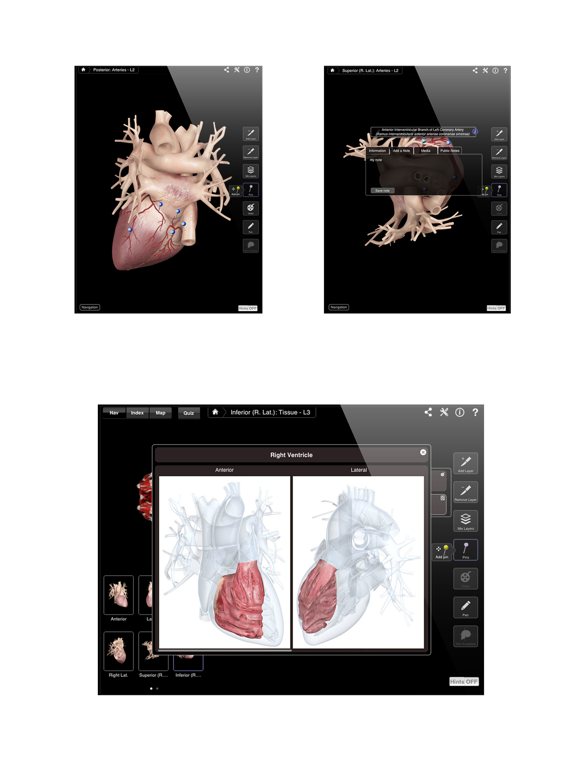 Heart Pro III Screenshot 4