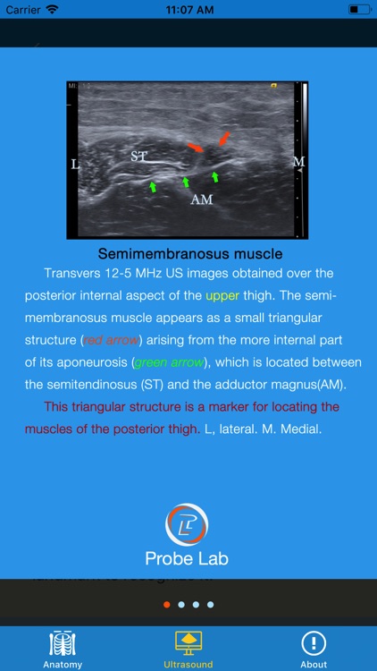 MSK Ultrasound: Thigh screenshot-3