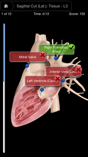 Heart Pro III - iPhone(圖5)-速報App