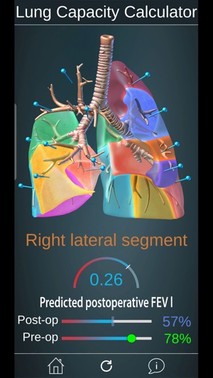 Surgical Anatomy of the Lung(圖2)-速報App