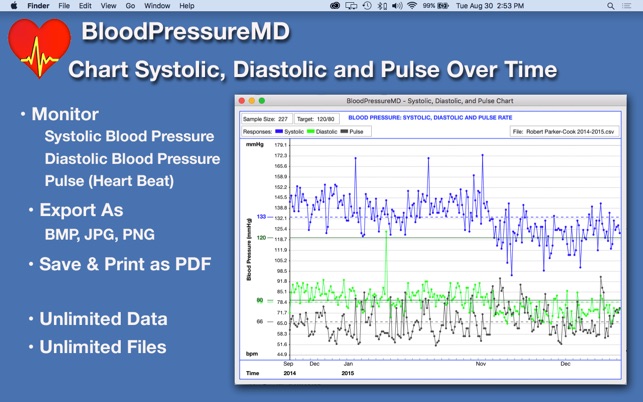Pulse Pressure Chart