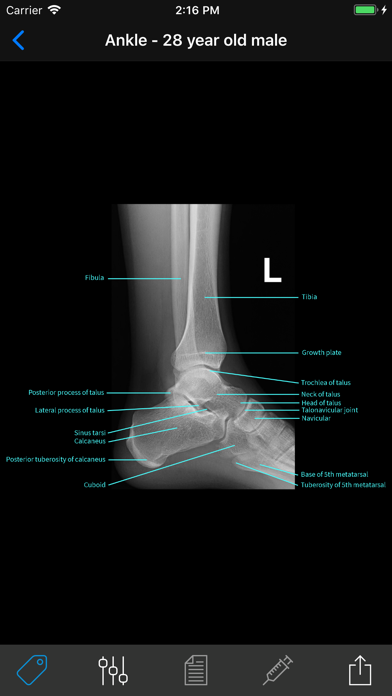 Normal X-Rays and Real Cases screenshot 2