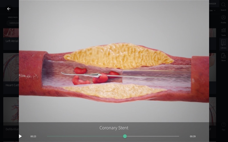 Complete_Anatomy_2019.app caprure 7 7_Complete_Anatomy_2019.jpg