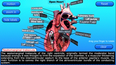 Open Heart Motion screenshot 2
