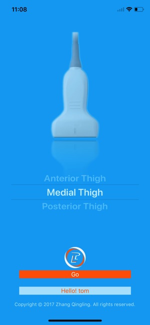 MSK Ultrasound: Thigh