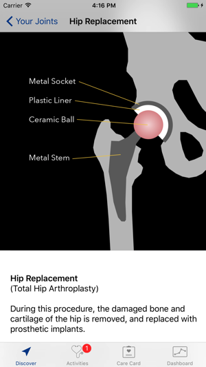 Motion at Michigan Medicine(圖2)-速報App