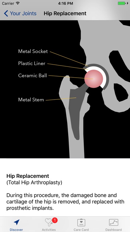 Motion at Michigan Medicine