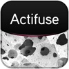 Actifuse