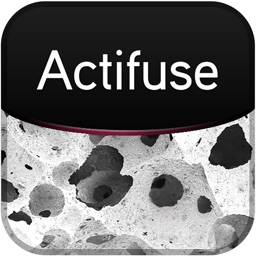 Actifuse