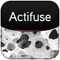 The ACTIFUSE [Bone Graft Substitute] iPad Application is designed to give medical professionals in orthopedic and neurological specialties an ability to gain a greater understanding of the scientific background behind how ACTIFUSE accelerates bone formation and an opportunity to review the data that supports it