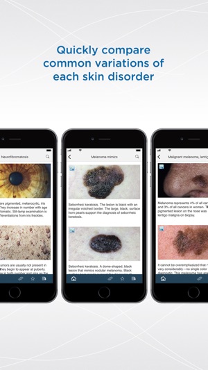 Dermatology DDx(圖3)-速報App