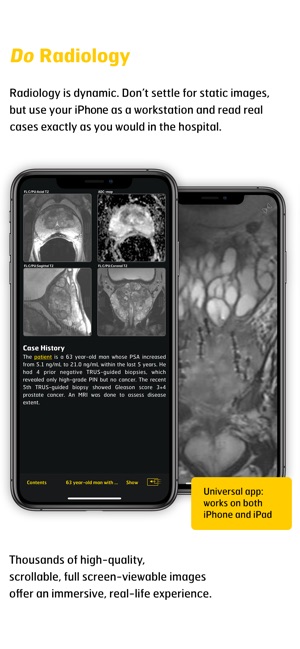 MR Imaging in Prostate Cancer(圖3)-速報App