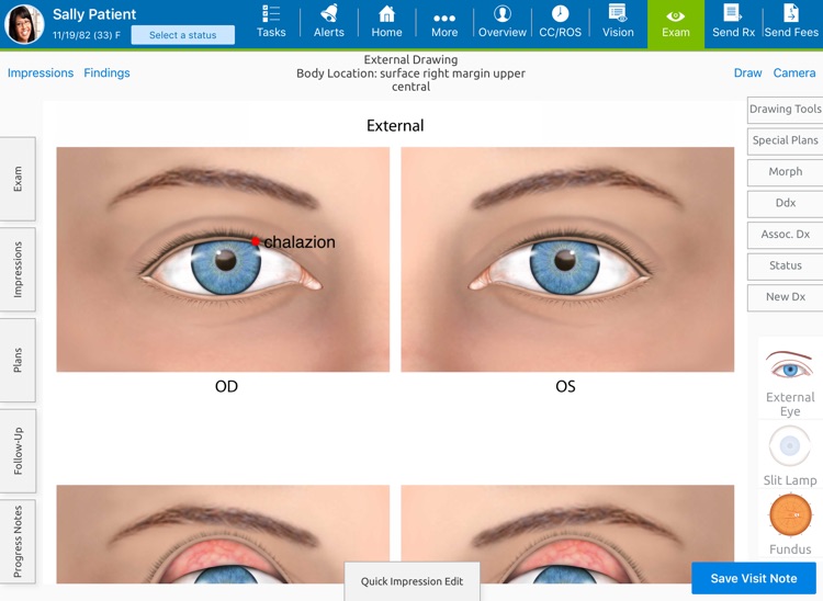 Eyefinity EHR