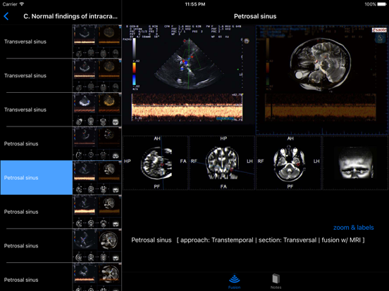 Sonographic Brain Atlasのおすすめ画像3