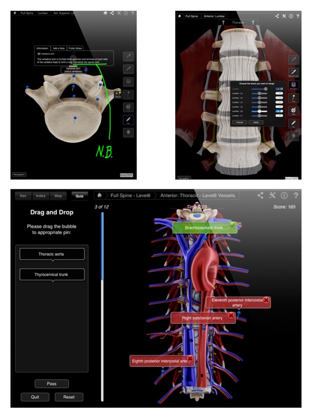 Spine Pro III(圖5)-速報App