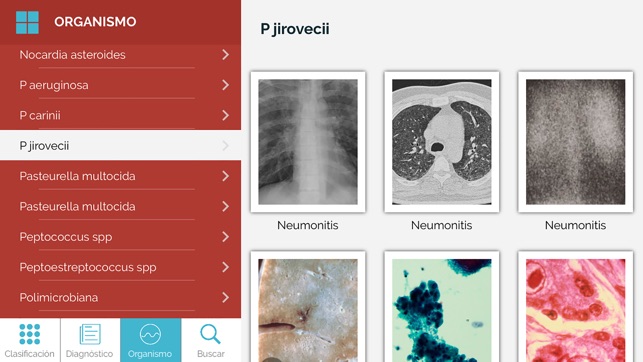 Dicc. Enfermedades infecciosas(圖3)-速報App