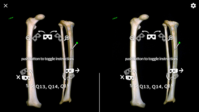 MacAnatomy VRBR(圖2)-速報App