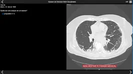 Game screenshot Fibrose pulmonaire 2017 apk