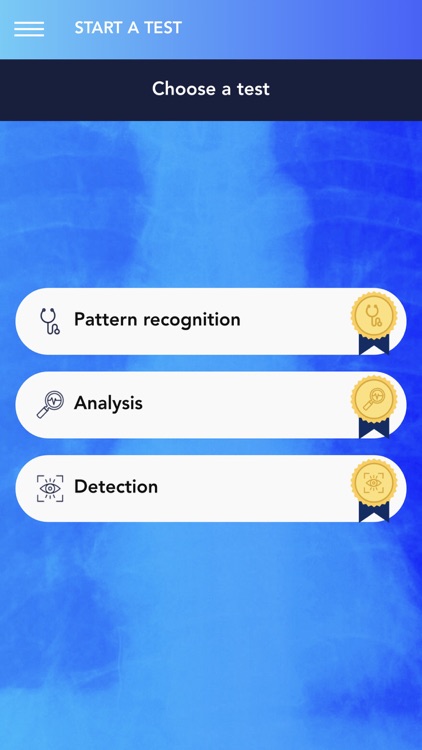 Chest X-Ray Experience