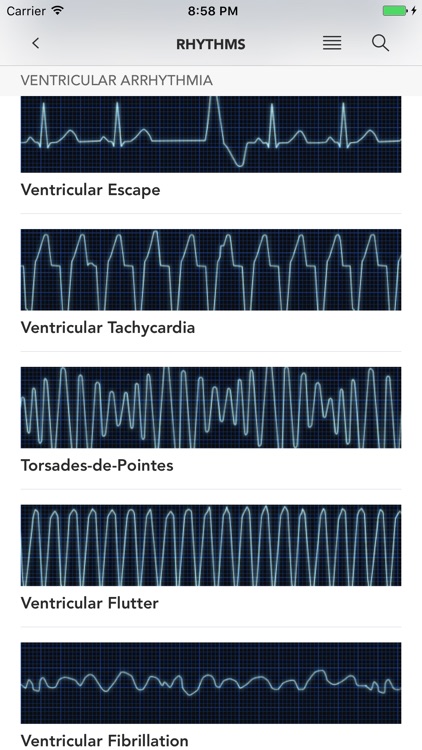 Instant ECG - Mastery of EKG