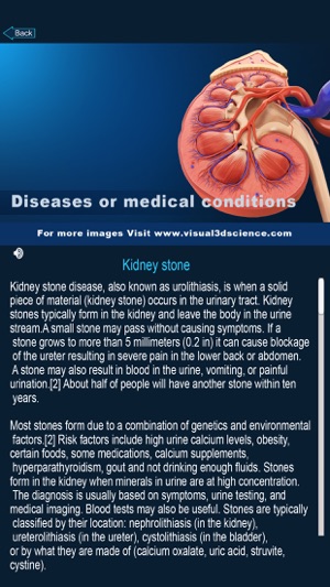 My Kidney Anatomy(圖4)-速報App