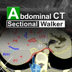 Abdominal CT Sectional Walker