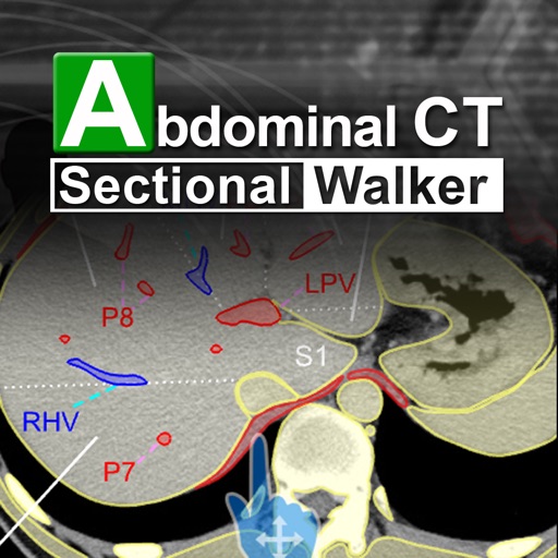 Abdominal CT Sectional Walker